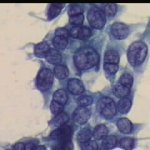 Ομάδα κυττάρων ενδοτραχήλου.